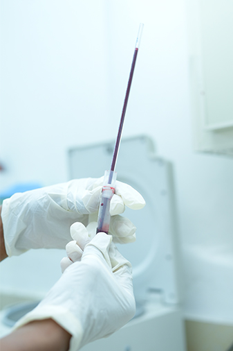 moat advanced testing methods